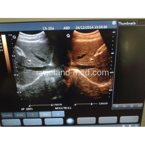 Sura ya Ultrasound Scanner Digital Ultrasound Machine Price
